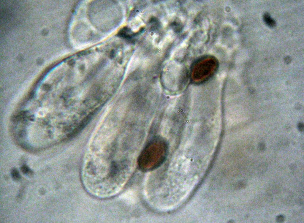 Inocybe (forse) con micro